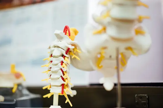 CLOSE-UP OF NECK AND UPPER SPINE SHOWING TENSION AND STIFFNESS, HIGHLIGHTING CHIROPRACTIC CARE SOLUTIONS AT ANGEL CHIROPRACTIC IN BRISBANE